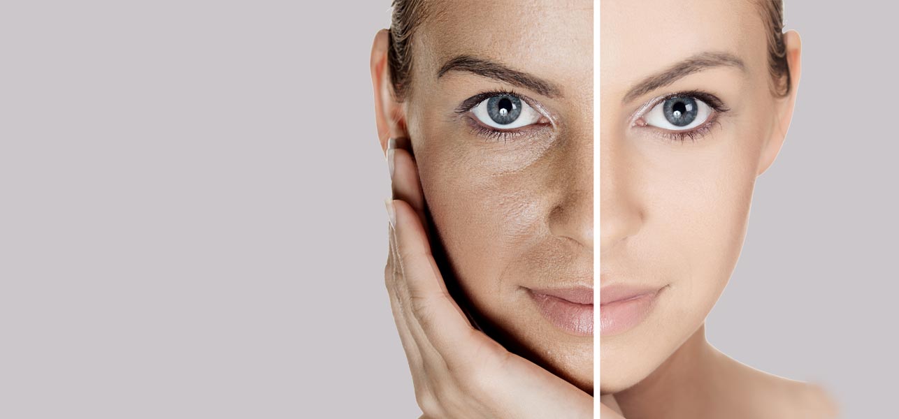 Направете сами: Природен лосион за проширени пори